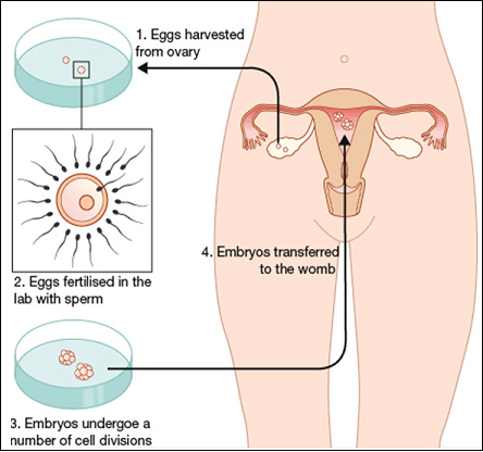 Embryo Transfer